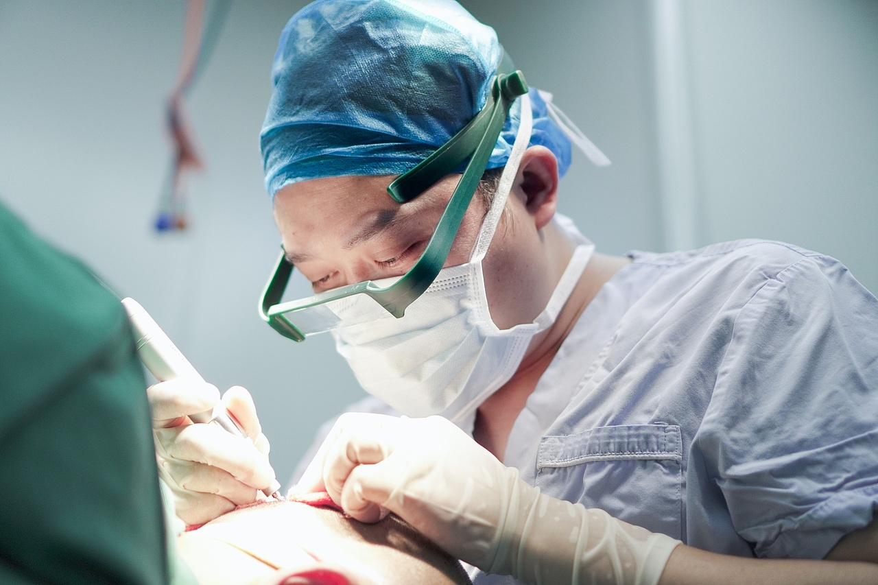 毛发种植医生术中纪实