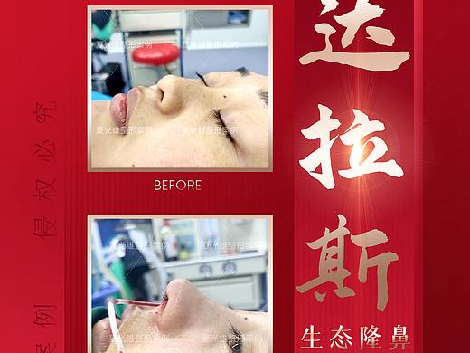 医美整形案例（个人主页-ZNDg3NzQyNTY=） - 海报 - 站酷设计师爱狗的包子原创素材 - 站酷ZCOOL