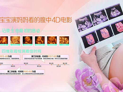 四维彩超 