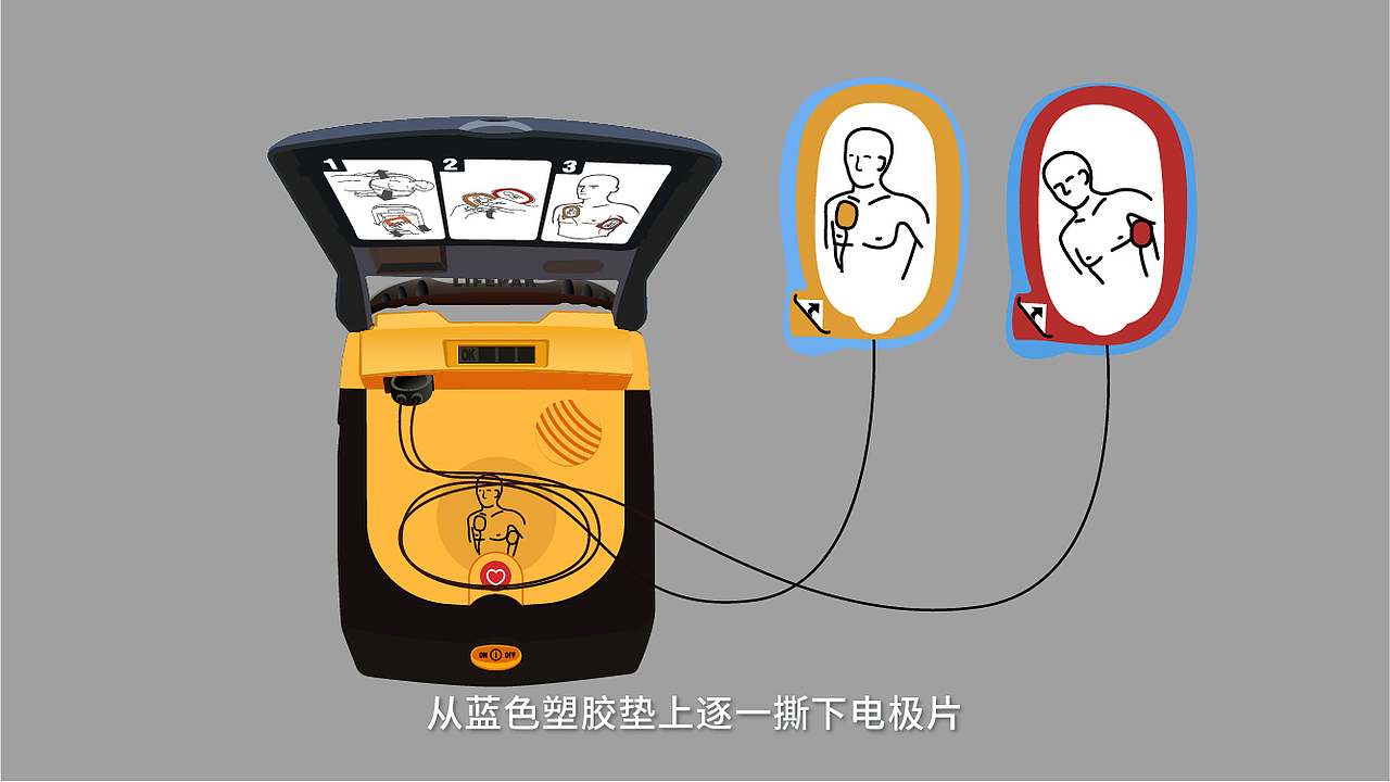 自动体外除颤器(aed)操作动画