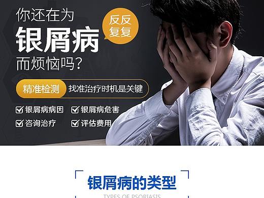 牛皮癣专题-医疗行业皮肤病手机/移动端专题/网页