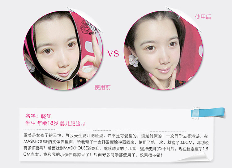 瘦脸的宝贝详情页面