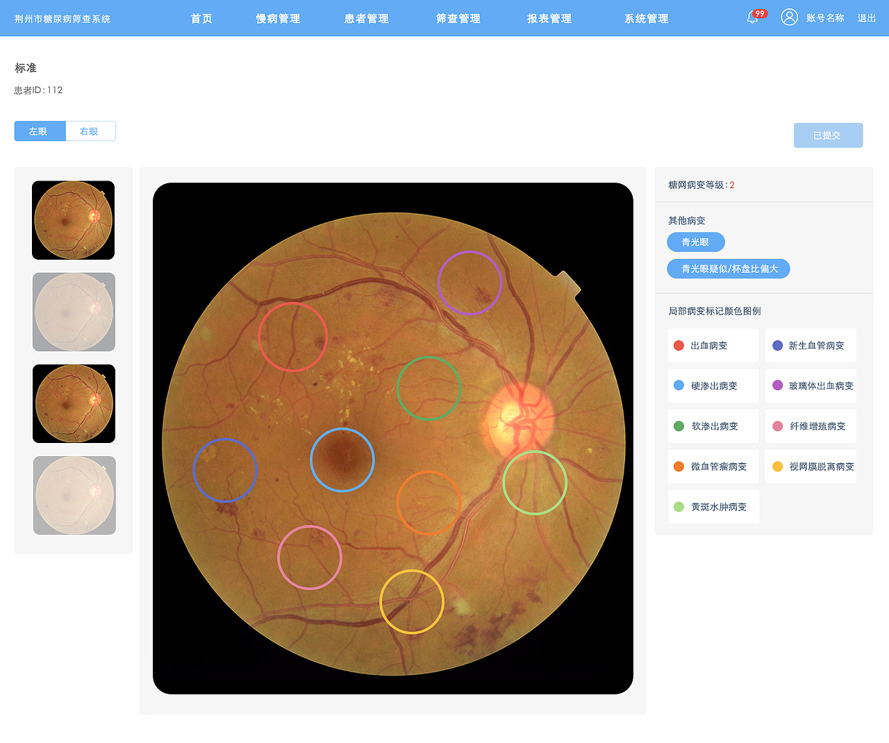 医疗眼底镜部分（图ZMTM0NDMzNzcy） - 软件界面 - 站酷设计师磨人哒小妖精原创素材 - 站酷ZCOOL
