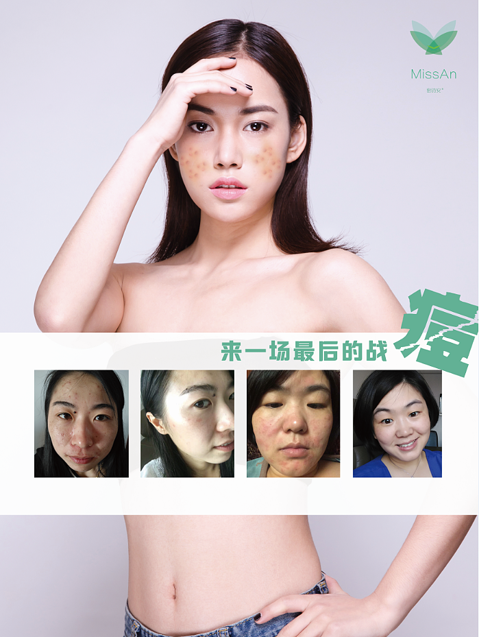 MissAn（图ZOTkzMDk2Njg=） - 其他 - 站酷设计师张寂原创素材 - 站酷ZCOOL