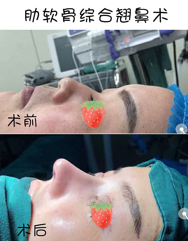 醫(yī)美對比案例系列(精品)（圖ZMTk4NzkzNjY4） - 宣傳物料 - 站酷設(shè)計(jì)師劉沐安創(chuàng)意設(shè)計(jì)原創(chuàng)素材 - 站酷ZCOOL