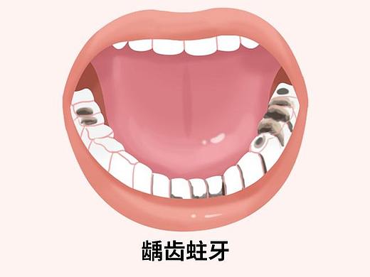 医美、牙齿疾病