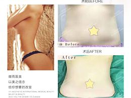 周绍龙博士整形团队案例对比图