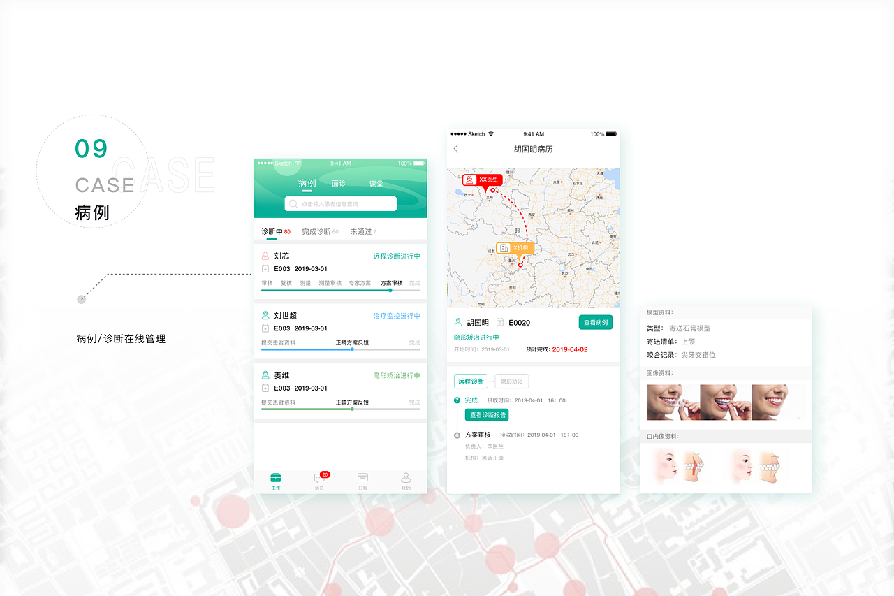 口腔正畸医疗端APP（图ZMjU1NTQzMTA0） - APP界面 - 站酷设计师迪斯尼在逃设计师原创素材 - 站酷ZCOOL