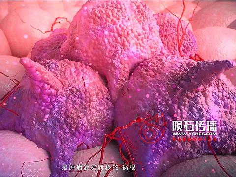 医学动画-细胞癌症