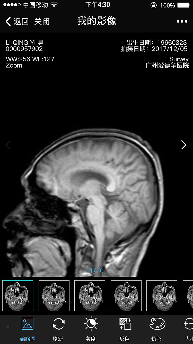 医疗影像h5页面设计