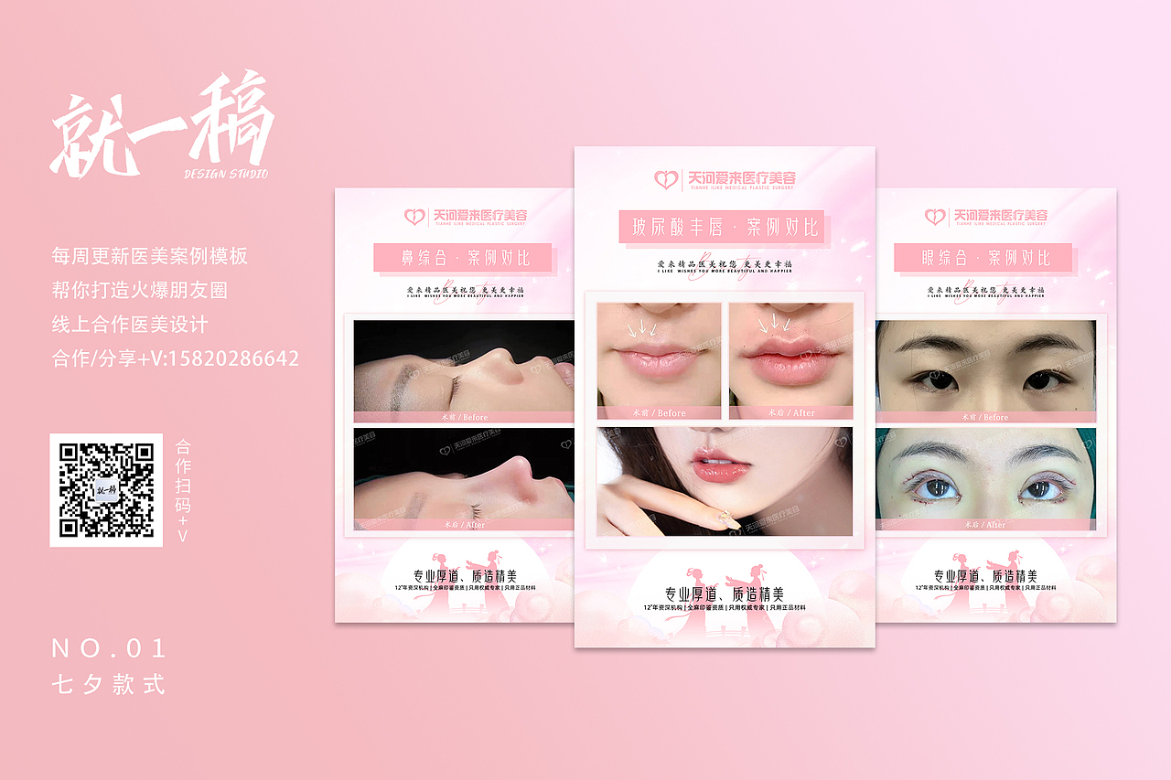 医美案例图｜七夕款式01（图ZMjY2NzU1MjQ4） - 宣传物料 - 站酷设计师就一稿设计原创素材 - 站酷ZCOOL