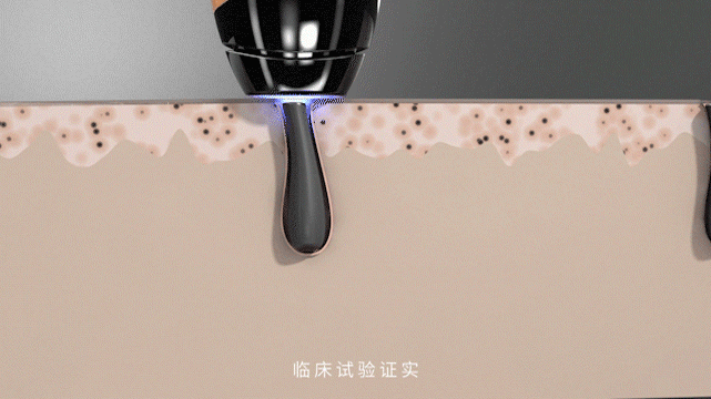 电商主图视频 | smoothskin脱毛仪 ✖ 三拾传媒（图ZMjAwMjU0OTMy） - 短片 - 站酷设计师三拾传媒原创素材 - 站酷ZCOOL