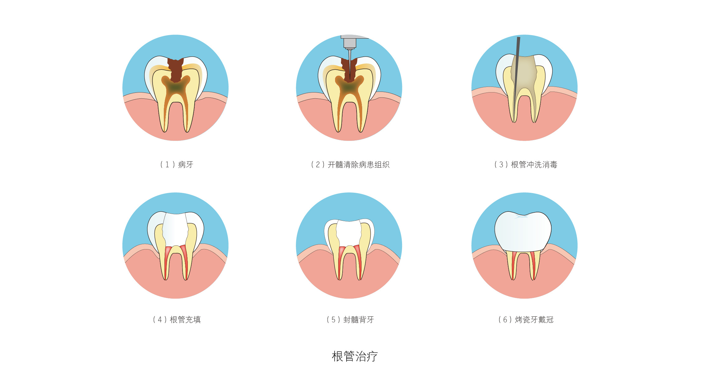 爱护牙齿|插画|商业插画|SINGU - 临摹作品 - 站酷 (ZCOOL)
