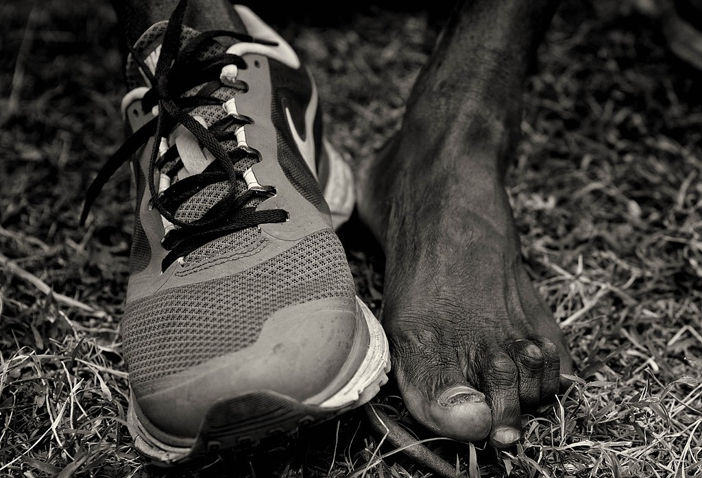 一位马拉松运动员的脚