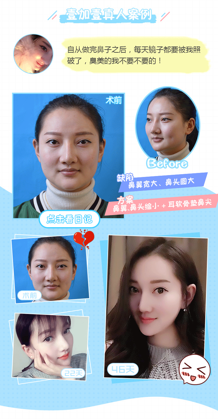鼻综合详情页