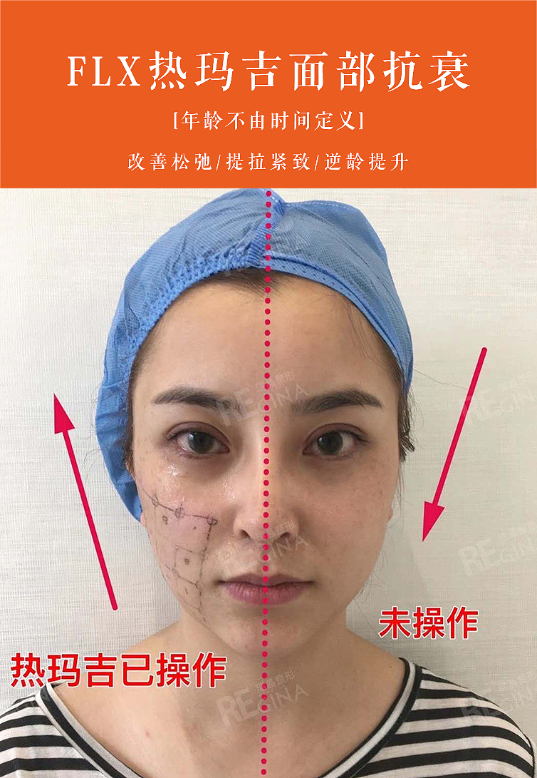 医美早安案例（图ZMjIwMzkxNzE2） - 电商 - 站酷设计师zqy1251100原创素材 - 站酷ZCOOL