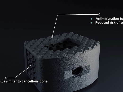 颈椎椎间融合器