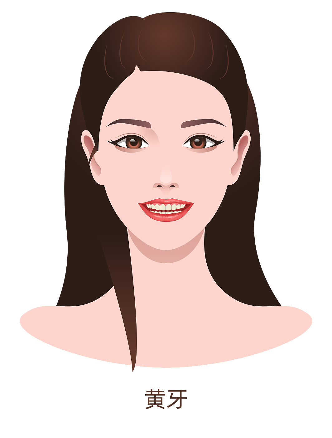 多生牙、氟斑牙、黄牙、四环素牙、牙结石（图ZMzA4MjU0NjI4） - 商业插画 - 站酷设计师蜀文途话原创素材 - 站酷ZCOOL