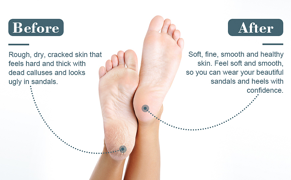 白色磨脚器（图ZMzQ4MzY3OTAw） - 电商 - 站酷设计师时光巷陌zf原创素材 - 站酷ZCOOL