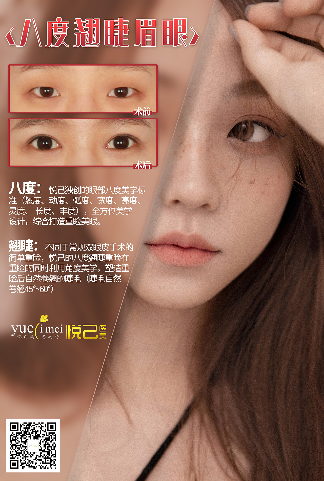 医美案例对比图