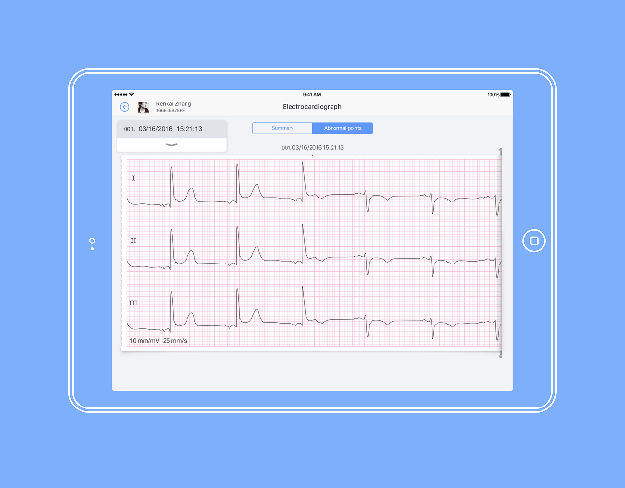 ihealth ecg 3导心电