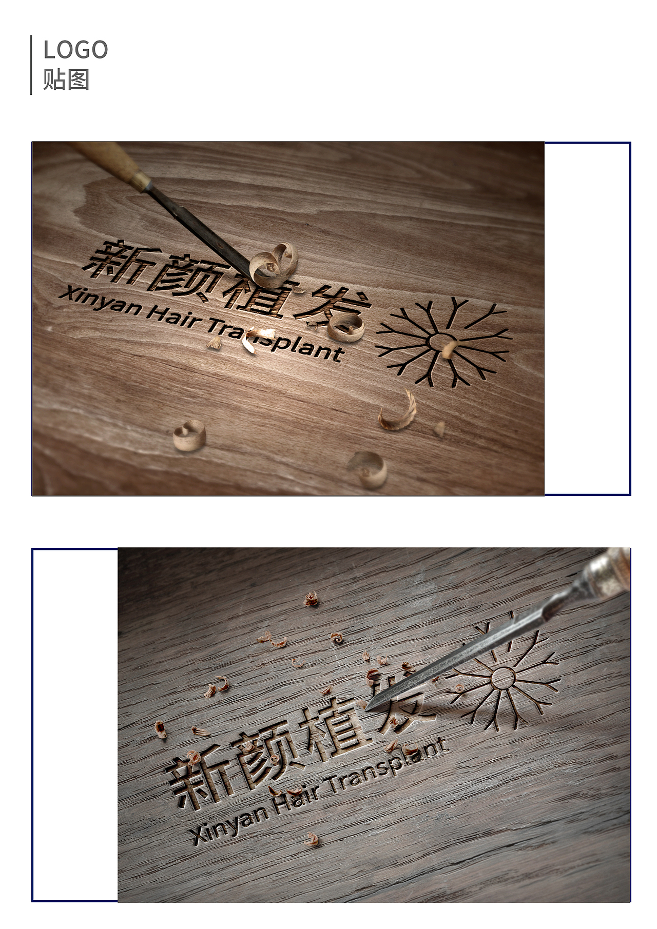 植发类  logo 设计