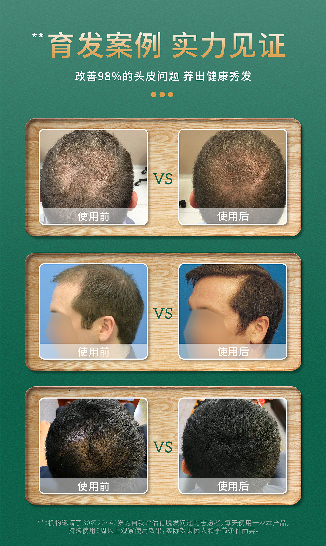 防脱育发设计效果展示（图ZMjczNzE5ODAw） - 海报 - 站酷设计师HarlinD原创素材 - 站酷ZCOOL