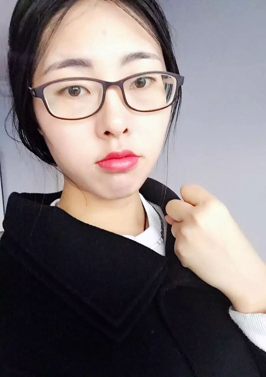 丑丑的自己 破相了(勿喷)