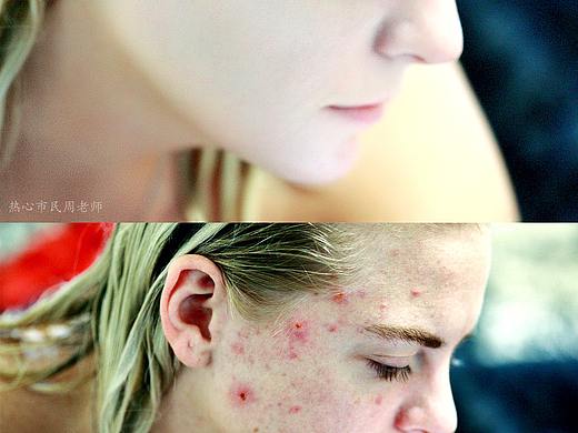 人像精修（个人主页-ZNTU5NjMwNjQ=） - 修图/后期 - 站酷设计师热心市民周老师原创素材 - 站酷ZCOOL