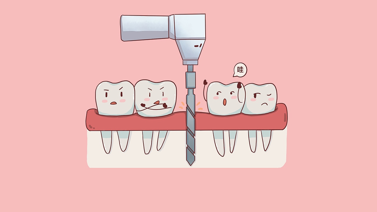 种牙流程（图ZMTgyNzEzNjY0） - 创作习作 - 站酷设计师刘玉美口腔插画原创素材 - 站酷ZCOOL