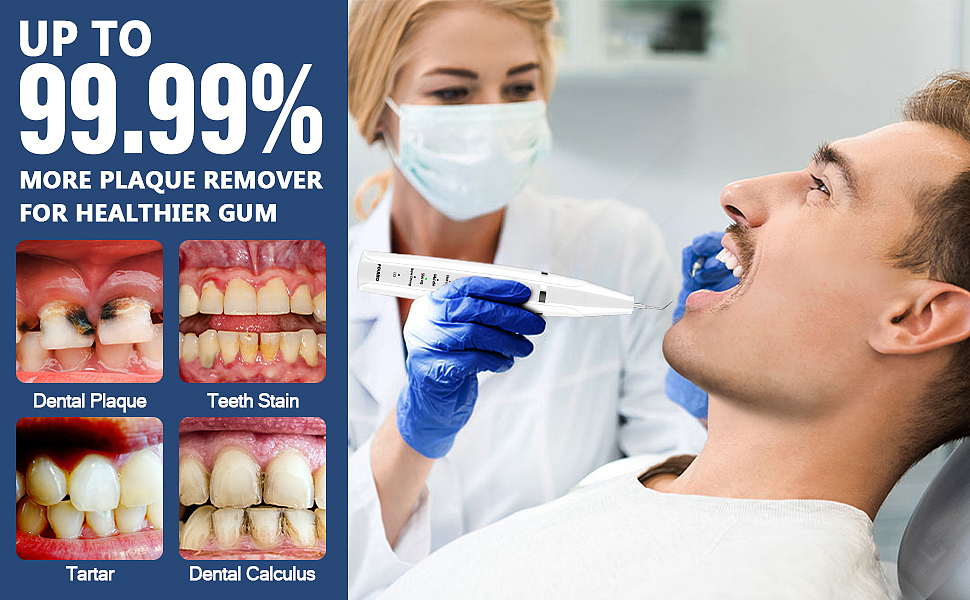 洁牙器（图ZMjY4MDMxNDMy） - 生活用品 - 站酷设计师烧酒蘸豆腐原创素材 - 站酷ZCOOL