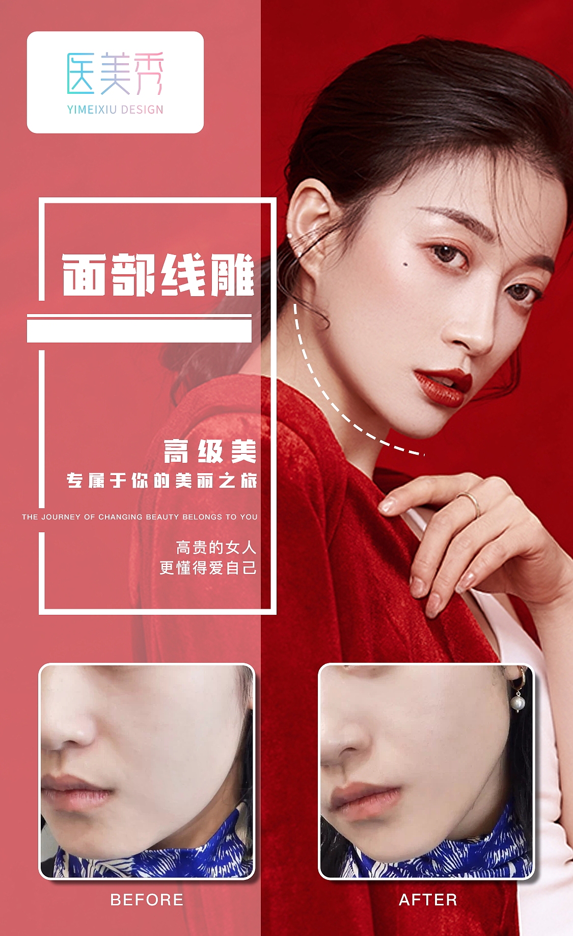 整形案例医美对比图