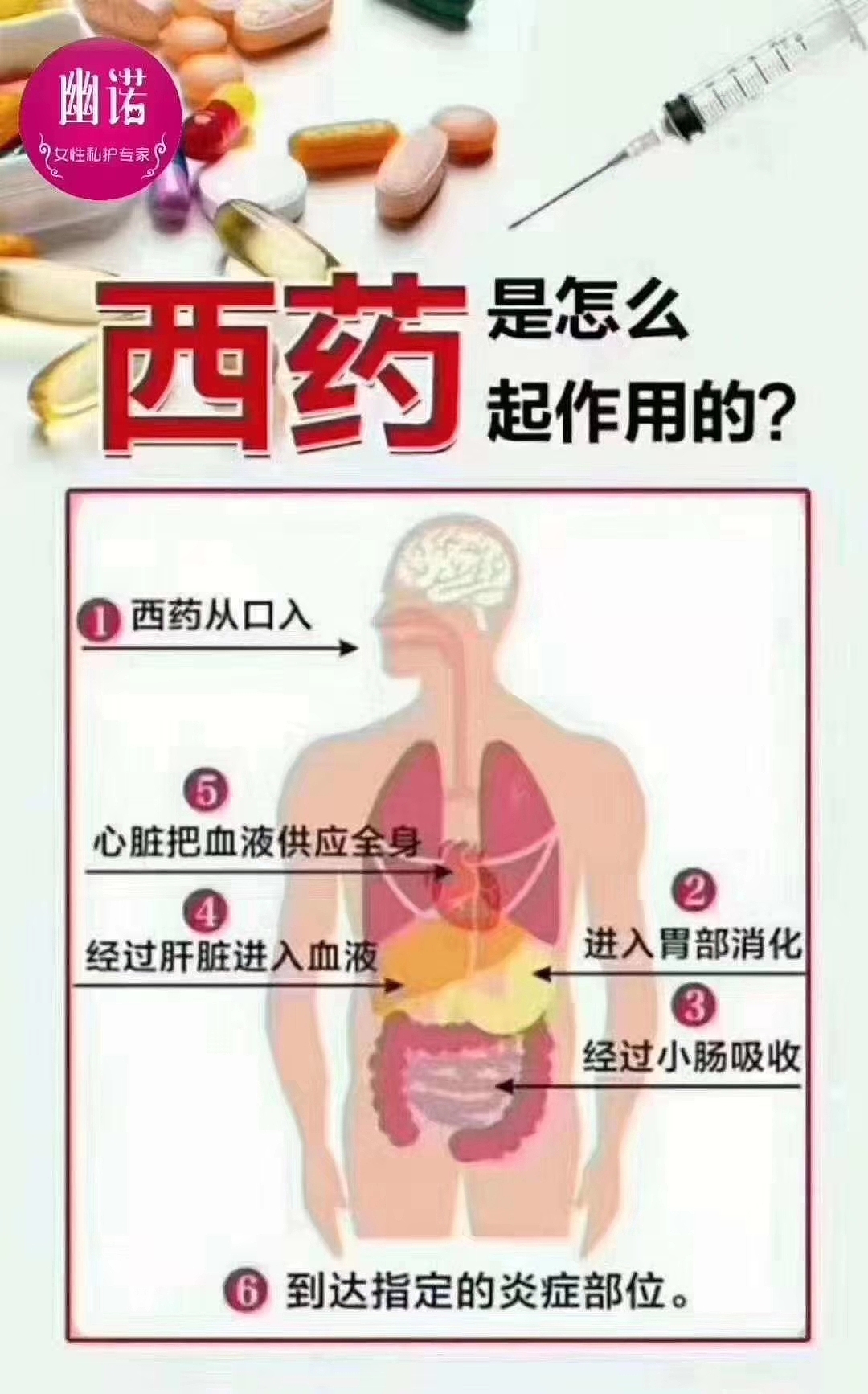 妇科病反复该怎么办?幽诺女神是什么?效果真的好