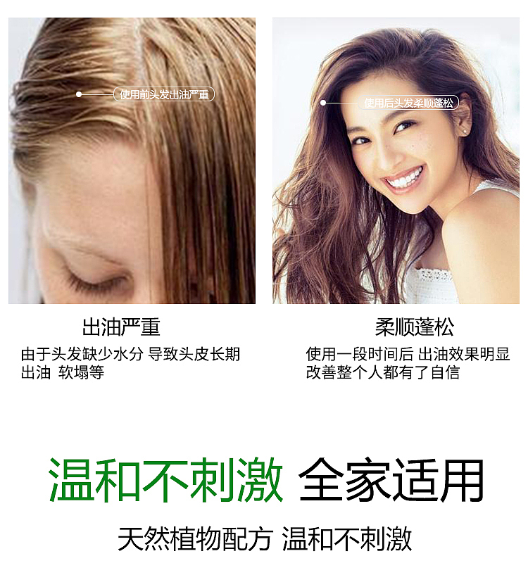 姜医生防脱洗发水