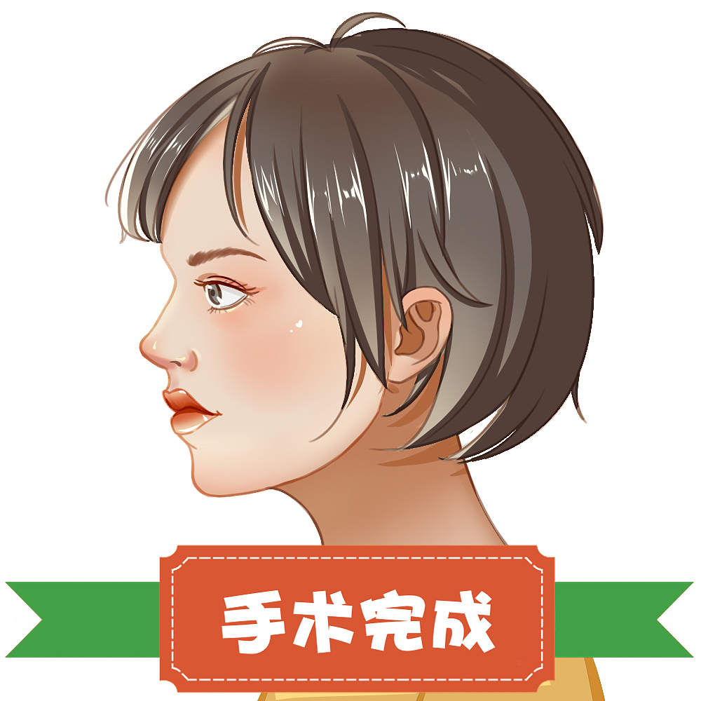 隆鼻过程医疗插画