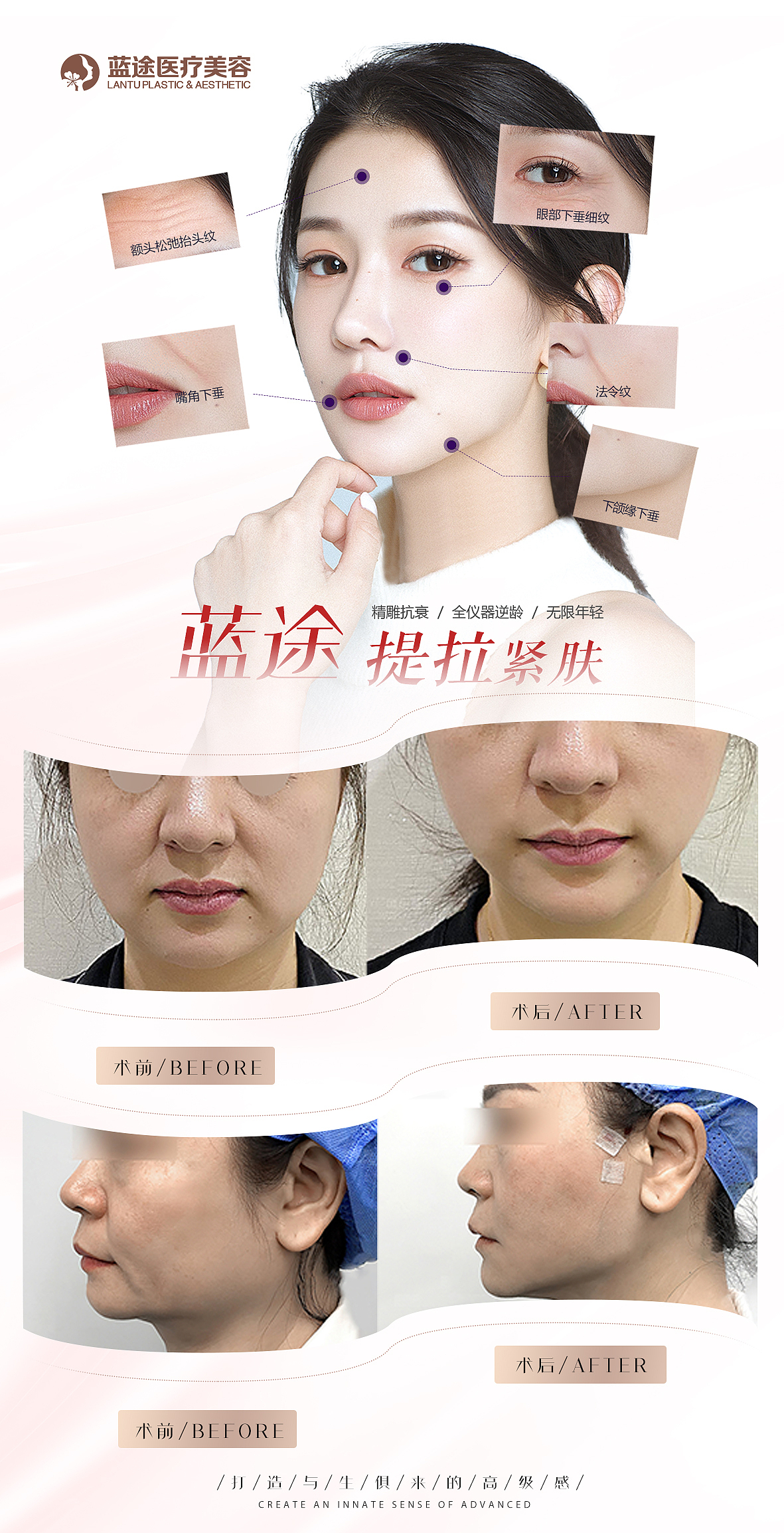 医美案例系列海报