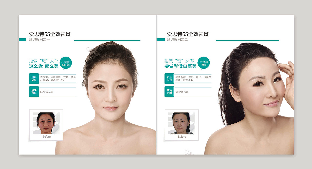 整形 平面 祛斑 畫(huà)冊(cè)（圖ZNTA1MjIwNDA=） - 書(shū)籍/畫(huà)冊(cè) - 站酷設(shè)計(jì)師不懶惰 不悲觀原創(chuàng)素材 - 站酷ZCOOL