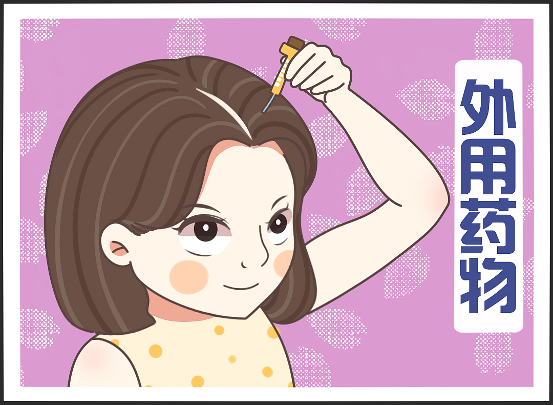 脱发 植发 脱发原因 病理性脱发 产后脱发 发际线