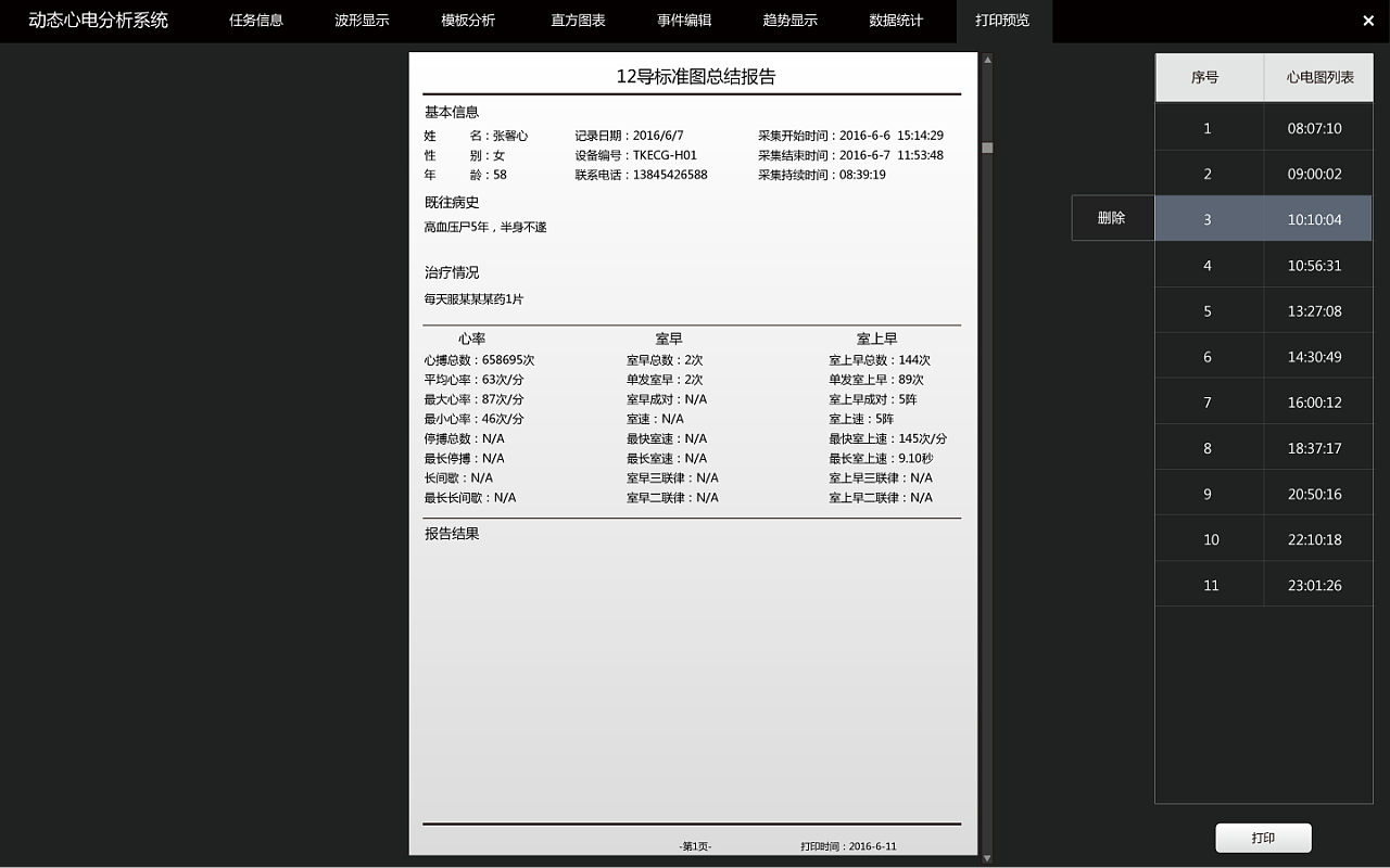 医疗类holter系统软件