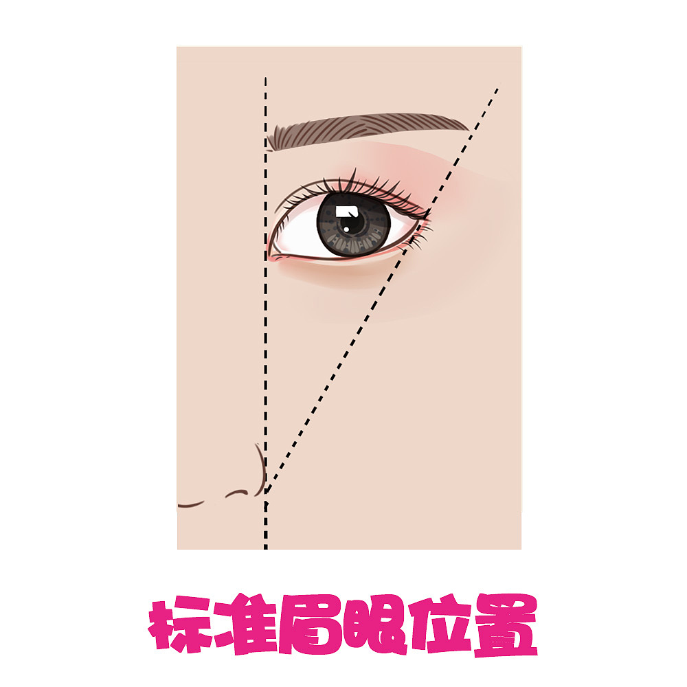 双眼皮分类--双眼皮手术设计