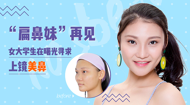 新氧/banner