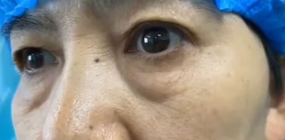 郑州袪眼袋手术,摆脱眼袋问题过程分享（图ZMjI0NTY0Mjgw） - 其他 - 站酷设计师郑州双眼皮医生原创素材 - 站酷ZCOOL