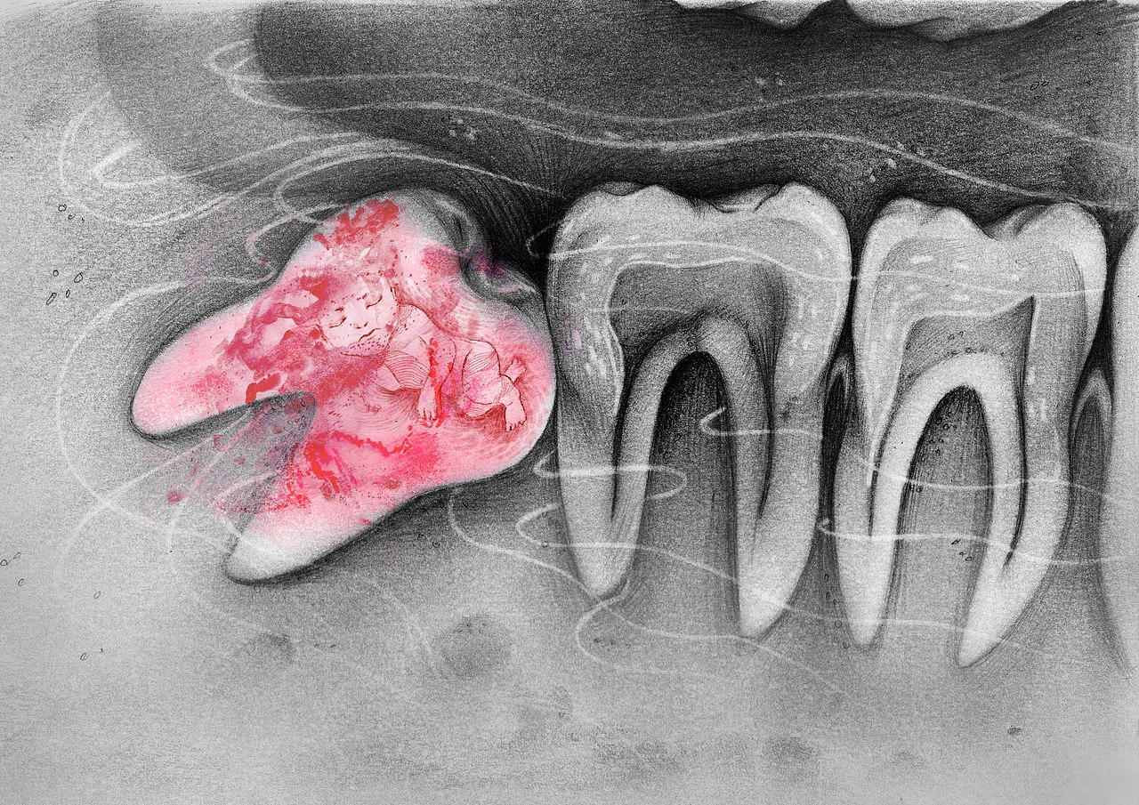【1306/0528】
拔了第二颗智齿<br>第四天<br>丧失精神<br>生了场莫名的病<br>总觉得生活很多的不可抗力