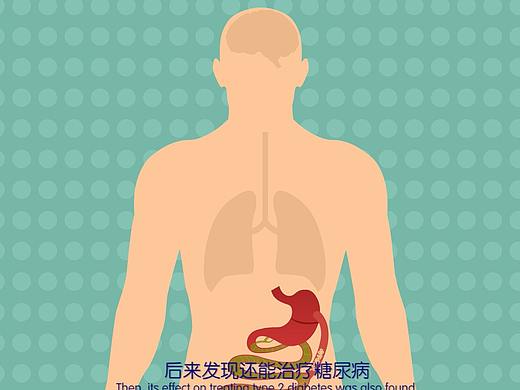 MG动画医疗动画企业宣传动画产品广告动画二维动画