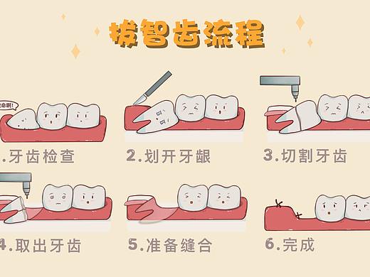 拔智齿流程（个人主页-ZNDAzMjA1NjA=） - 艺术插画 - 站酷设计师刘玉美口腔插画原创素材 - 站酷ZCOOL
