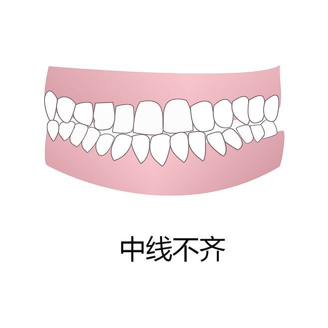 医美,牙齿 口腔 漫画 插画 卡通 牙齿矫正 牙齿疾病