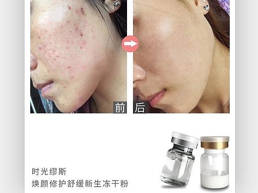 时光缪斯焕颜修护舒缓新生冻干粉 