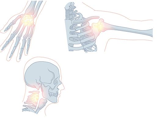 【医疗医用插画绘制】