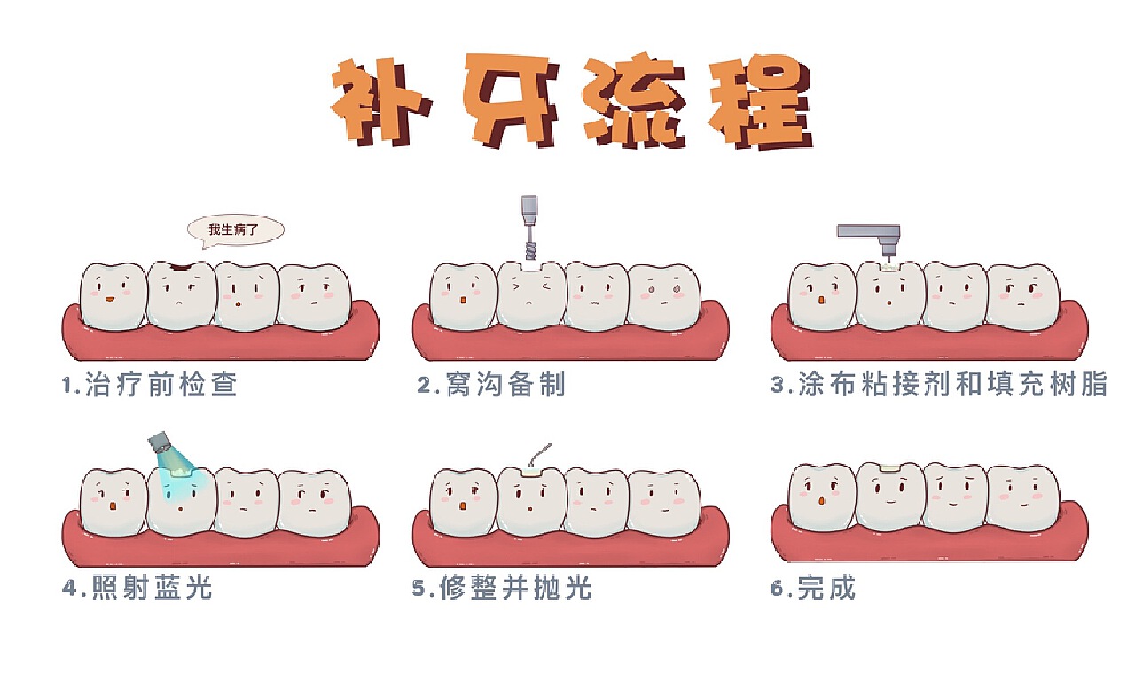 蛀牙早补早省钱，快来了解一下树脂补牙的过程-爱康健齿科