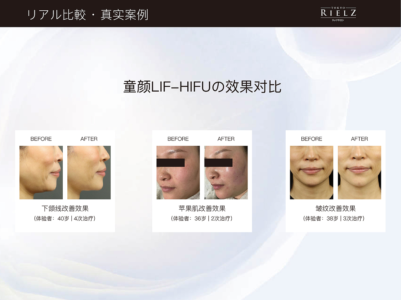 美容院护理项目册子（图ZMzI4OTMzNTYw） - 海报 - 站酷设计师舒群貽原创素材 - 站酷ZCOOL